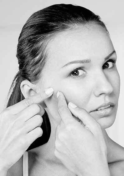 home popular acne treatment