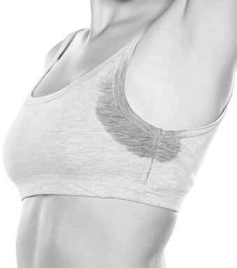 underarm sweat treatments