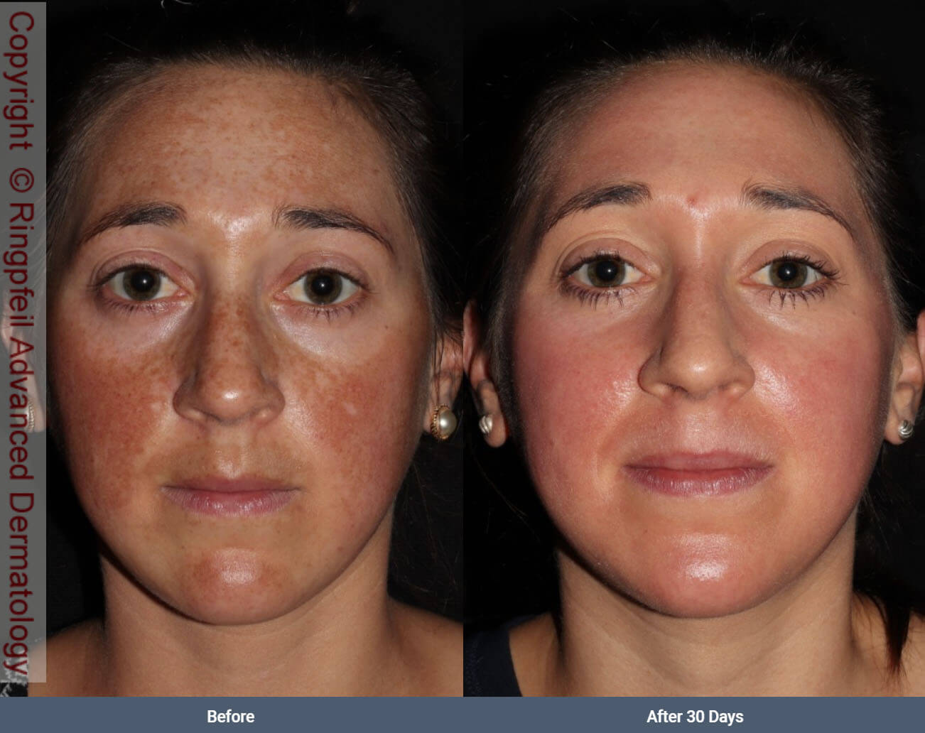 dermatologist before and after