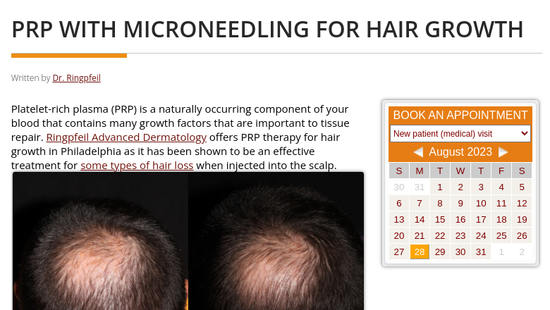 PRP FOR HAIR GROWTH