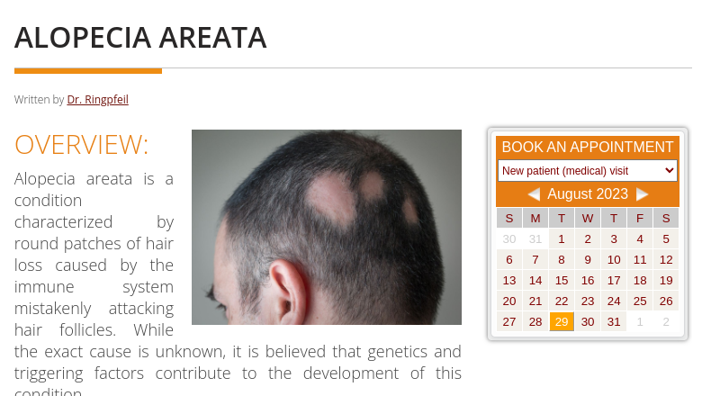 Alopecia Areata