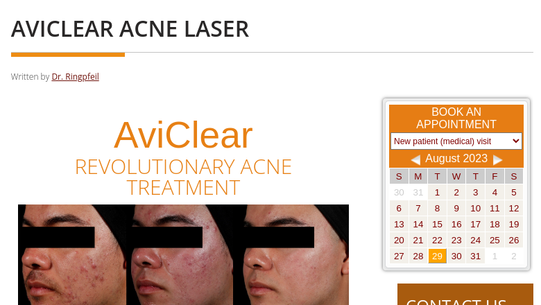 AviClear Acne Laser