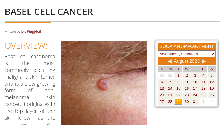 Basal Cell Cancer