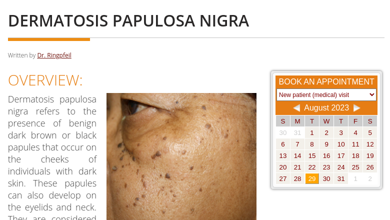 Dermatosis P. Nigra