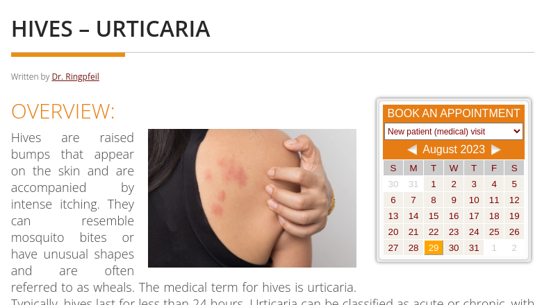 Hives - Urticaria